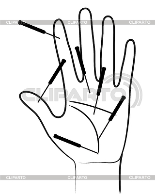 Mano acupunctured | Ilustración vectorial de stock |ID 4113048